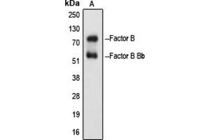 Western blot analysis of Factor B Bb expression in Raji Etoposide-treated (A) whole cell lysates. (Complement B + Bb (Center) Antikörper)