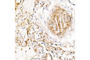 Immunohistochemistry of paraffin-embedded human lung using BST2 Rabbit pAb (ABIN6129547, ABIN6137673, ABIN6137675 and ABIN6215924) at dilution of 1:100 (40x lens). (BST2 Antikörper  (AA 49-161))