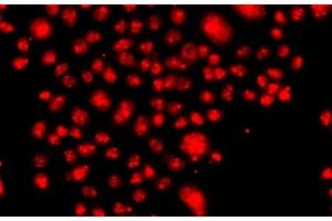 Immunofluorescence analysis of A549 cells using FANCM Polyclonal Antibody (FANCM Antikörper)