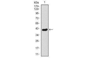 Image no. 1 for anti-Twist Homolog 1 (Drosophila) (TWIST1) antibody (ABIN1491700) (TWIST1 Antikörper)