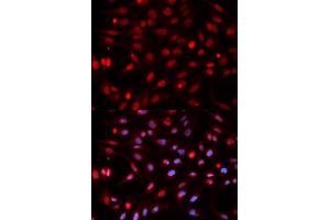 Immunofluorescence analysis of HeLa cell using APEX1 antibody. (APEX1 Antikörper)