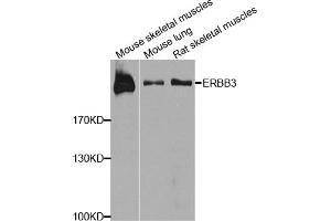 Western blot analysis of extracts of various cell lines, using ERBB3 antibody (ABIN1876761) at 1:1000 dilution. (ERBB3 Antikörper)