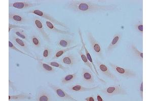 Immunocytochemistry analysis of Hela cells using ABIN7139153 at dilution of 1:100 (HIST1H4A Antikörper  (acLys12))