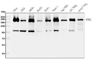 Western blot analysis of Periplakin using anti-Periplakin antibody (ABIN5518787). (PPL Antikörper  (C-Term))