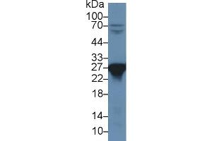Western blot analysis of Rat Liver lysate, using Rat PRDX6 Antibody (1 µg/ml) and HRP-conjugated Goat Anti-Rabbit antibody ( (Peroxiredoxin 6 Antikörper  (AA 1-224))