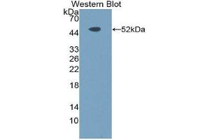 Western Blotting (WB) image for anti-Toll-Like Receptor 10 (TLR10) (AA 617-784) antibody (ABIN1871633)