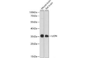 Western blot analysis of extracts of various cell lines using SLC25A27 Polyclonal Antibody at dilution of 1:1000. (SLC25A27 Antikörper)