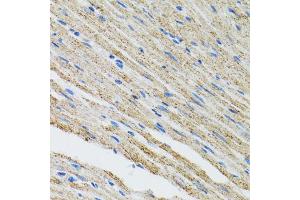 Immunohistochemistry of paraffin-embedded mouse heart using MYOT antibody (ABIN5973839) at dilution of 1/100 (40x lens). (Myotilin Antikörper)