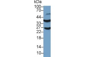 Detection of GAPDH in Human Liver lysate using Polyclonal Antibody to Glyceraldehyde-3-Phosphate Dehydrogenase (GAPDH) (GAPDH Antikörper  (AA 154-324))