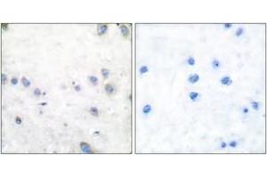 Immunohistochemistry analysis of paraffin-embedded human brain, using COT (Phospho-Thr290) Antibody. (CROT Antikörper  (pThr290))
