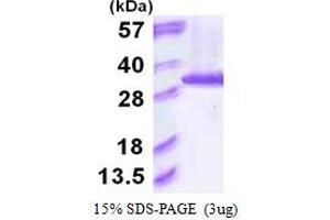 SDS-PAGE (SDS) image for Proteasome Subunit alpha 6 (PSMA6) (AA 1-246) protein (His tag) (ABIN666621)