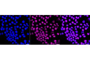 Immunocytochemical staining of HeLa cells with HIF1AN antibody (ABIN7799018), 1:1,000).