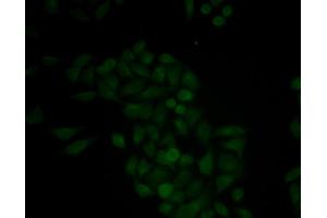 Immunofluorescence analysis of MCF-7 cells using CTSE antibody. (Cathepsin E Antikörper)