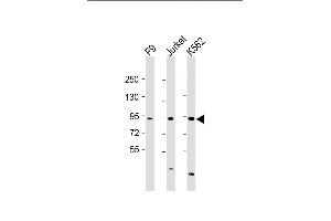 All lanes : Anti-NUP93 Antibody (N-Term) at 1:2000 dilution Lane 1: F9 whole cell lysate Lane 2: Jurkat whole cell lysate Lane 3: K562 whole cell lysate Lysates/proteins at 20 μg per lane. (NUP93 Antikörper  (AA 20-54))