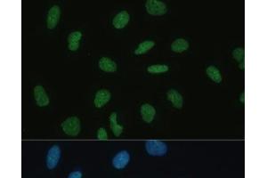 Immunofluorescence analysis of U-2 OS cells using MKL1 Polyclonal Antibody at dilution of 1:100 (40x lens). (MKL1 Antikörper)