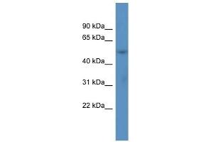 Western Blot showing ACOT9 antibody used at a concentration of 1 ug/ml against Fetal Lung Lysate