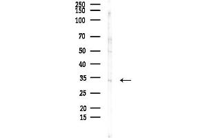 Western blot analysis of lysates from COLO205 cells, using CNN2 Antibody at 1/1000 dilution.