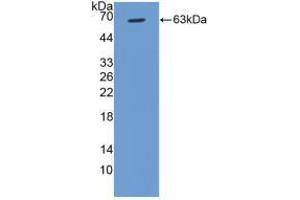 Western blot analysis of recombinant Human CCND1. (Cyclin D1 Antikörper  (AA 1-295))