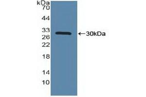 Detection of Recombinant MAPKAPK2, Human using Polyclonal Antibody to MAP Kinase Activated Protein Kinase 2 (MAPKAPK2) (MAPKAP Kinase 2 Antikörper  (AA 139-367))