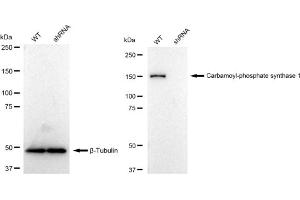 Western blotting analysis using Carbamoyl-phosphate synthase 1 antibody (ABIN7797865).