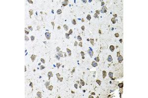 Immunohistochemistry of paraffin-embedded mouse brain using FGF1 antibody at dilution of 1:100 (x40 lens). (FGF1 Antikörper)