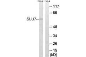 Western blot analysis of extracts from HeLa cells, using SLU7 Antibody. (SLU7 Antikörper  (AA 113-162))