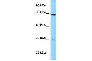 WB Suggested Anti-SNX11 Antibody Titration: 1. (SNX11 Antikörper  (Middle Region))