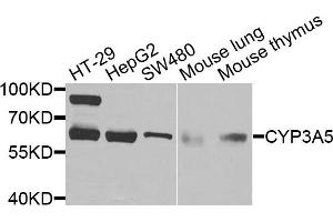 Western blot analysis of extracts of various cells, using CYP3A5 antibody. (CYP3A5 Antikörper)