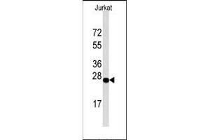 Image no. 1 for anti-DNA-Damage-Inducible Transcript 4 (DDIT4) (C-Term), (N-Term) antibody (ABIN358765) (DDIT4 Antikörper  (C-Term, N-Term))