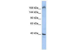 Western Blotting (WB) image for anti-Eukaryotic Translation Initiation Factor 4 Gamma, 1 (EIF4G1) (Middle Region) antibody (ABIN2778919)