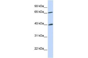 WB Suggested Anti-CHEK2 Antibody Titration:  0. (CHEK2 Antikörper  (N-Term))