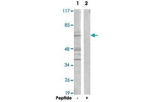 Western blot analysis of extracts from A-549 cells, using CERKL polyclonal antibody . (CERKL Antikörper)