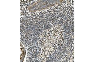 IHC analysis of SGK1 using anti-SGK1 antibody (ABIN7603118). (SGK1 Antikörper  (N-Term))
