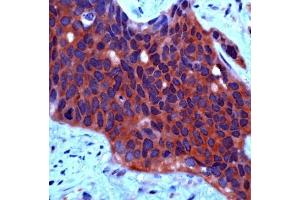 Human ovarian ca. (c-MET Antikörper  (C-Term))