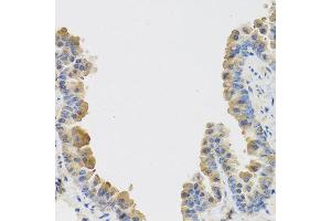 Immunohistochemistry of paraffin-embedded mouse lung using IL25 antibody at dilution of 1:100 (40x lens).