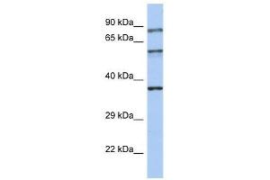 Western Blot showing RPH3A antibody used at a concentration of 1-2 ug/ml to detect its target protein.