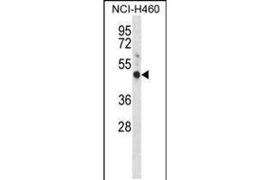 Western blot analysis in NCI-H460 cell line lysates (35ug/lane). (GYPE Antikörper  (C-Term))