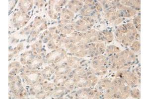 Immunohistochemical staining of formalin-fixed paraffin-embedded human stomach showing membrane staining with ADAM15 polyclonal antibody  at 1:100 dilution.