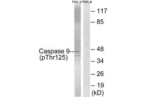 Western blot analysis of extracts from HeLa cells, treated with TNF (20ng/ml, 5mins) and calyculinA (50ng/ml, 15mins), using Caspase 9 (Phospho-Thr125) antibody. (Caspase 9 Antikörper  (pThr125))