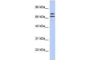 Human SH-SYSY; WB Suggested Anti-C3orf39 Antibody Titration: 0. (C3orf39 Antikörper  (N-Term))