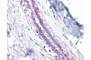 Immunohistochemistry (IHC) image for anti-Cadherin 1, Type 1, E-Cadherin (Epithelial) (CDH1) (AA 503-552) antibody (ABIN6745747)
