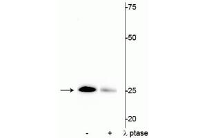 Western blot of mouse heart lysate showing specific immunolabeling of the ~25 kDa cardiac troponin I protein phosphorylated at Ser43 in the first lane (-). (TNNI3 Antikörper  (pSer43))