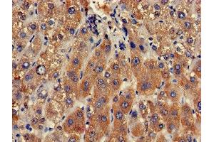 Immunohistochemistry of paraffin-embedded human liver tissue using ABIN7147821 at dilution of 1:100 (Clarin 2 Antikörper  (AA 31-100))