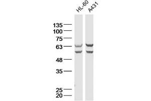 Lane 1: HL-60 Cell lysates; Lane 2: A431 Cell lysates; probed with Natriuretic Peptide Receptor C Polyclonal Antibody, unconjugated (bs-2333R) at 1:300 overnight at 4°C followed by a conjugated secondary antibody for 60 minutes at 37°C.