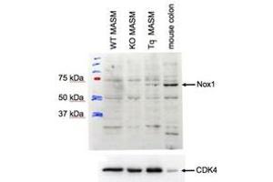 Western Blotting (WB) image for anti-NADPH Oxidase 1 (NOX1) (Internal Region) antibody (ABIN2464425) (NOX1 Antikörper  (Internal Region))