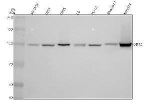 Western blot analysis of DDR2 using anti-DDR2 antibody (ABIN7604626).