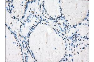 Image no. 4 for anti-P450 (Cytochrome) Oxidoreductase (POR) antibody (ABIN1497746) (POR Antikörper)