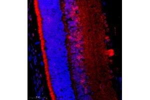 Immunofluorescence of paraffin embedded rat eye using FGF11 (ABIN7073941) at dilution of 1:2200 (400x lens) (FGF11 Antikörper)