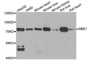 Western blot analysis of extracts of various cell lines, using GBE1 antibody. (GBE1 Antikörper  (AA 1-300))
