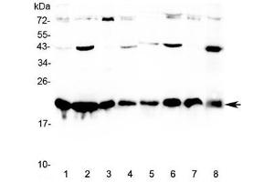 Western blot testing of human 1) HeLa, 2) MCF7, 3) COLO320, 4) HepG2, 5) placenta, 6) A549, 7) SKOV3, and 8) PANC-1 cell lysate with CBX3 antibody at 0. (CBX3 Antikörper)